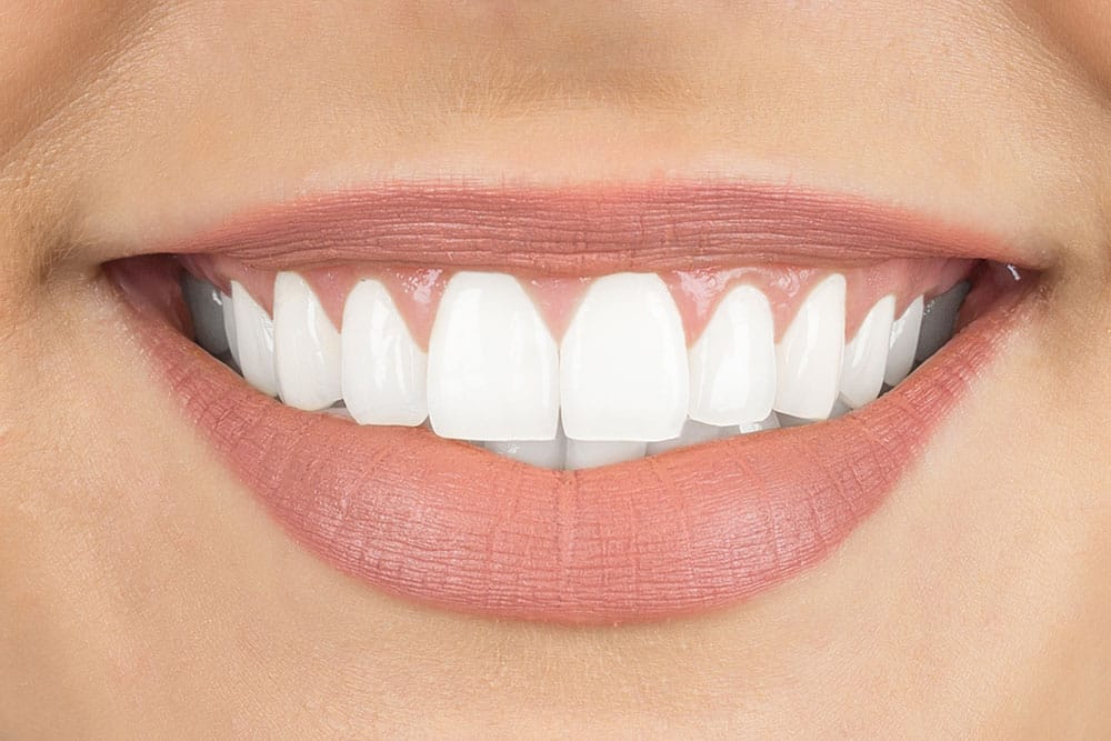 Veneers Are The Most Cost-Effective Way To A More Beautiful Smile