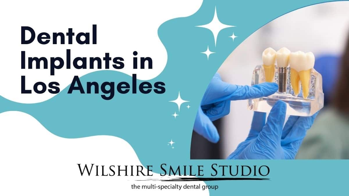 dental implants in los angeles