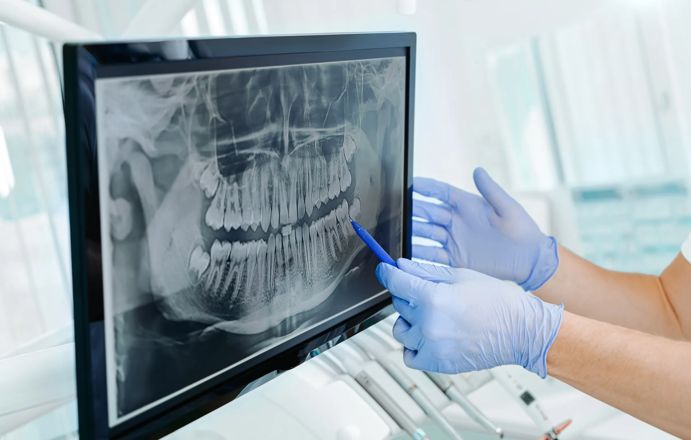 oral surgery los angeles ca​