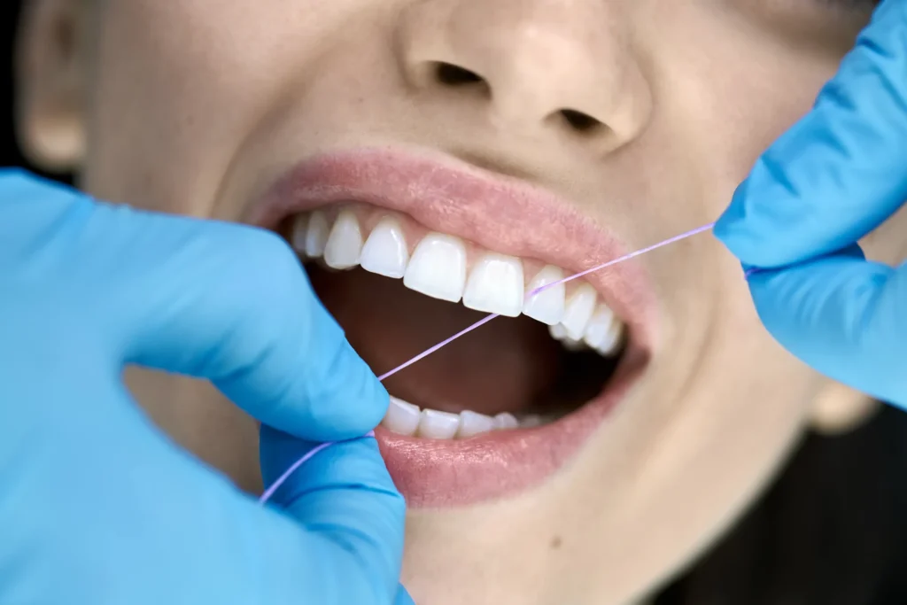 Dental Hygiene & Teeth Cleaning in Los Angeles, CA
