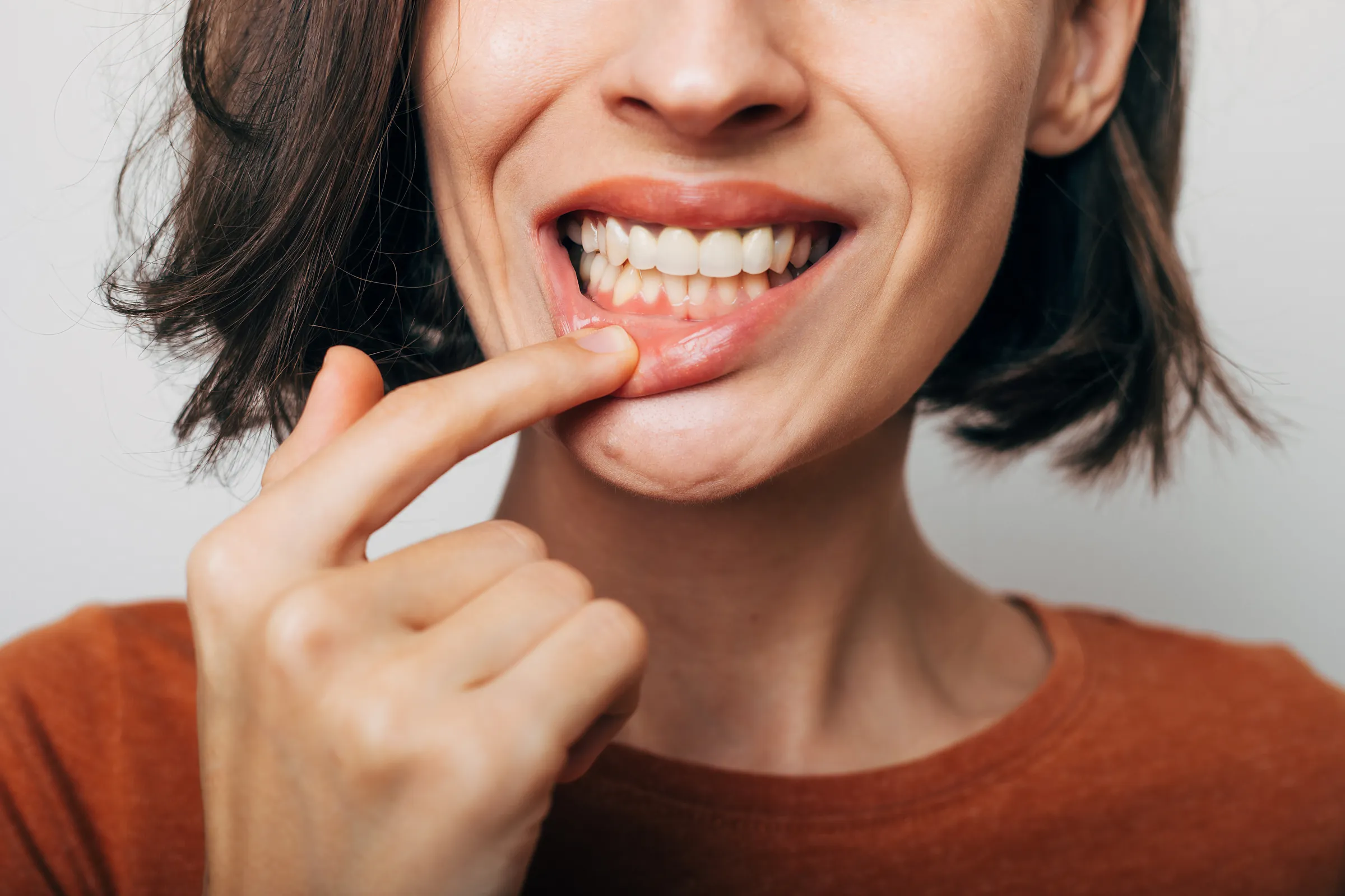 Periodontal Dentistry Los Angeles, CA