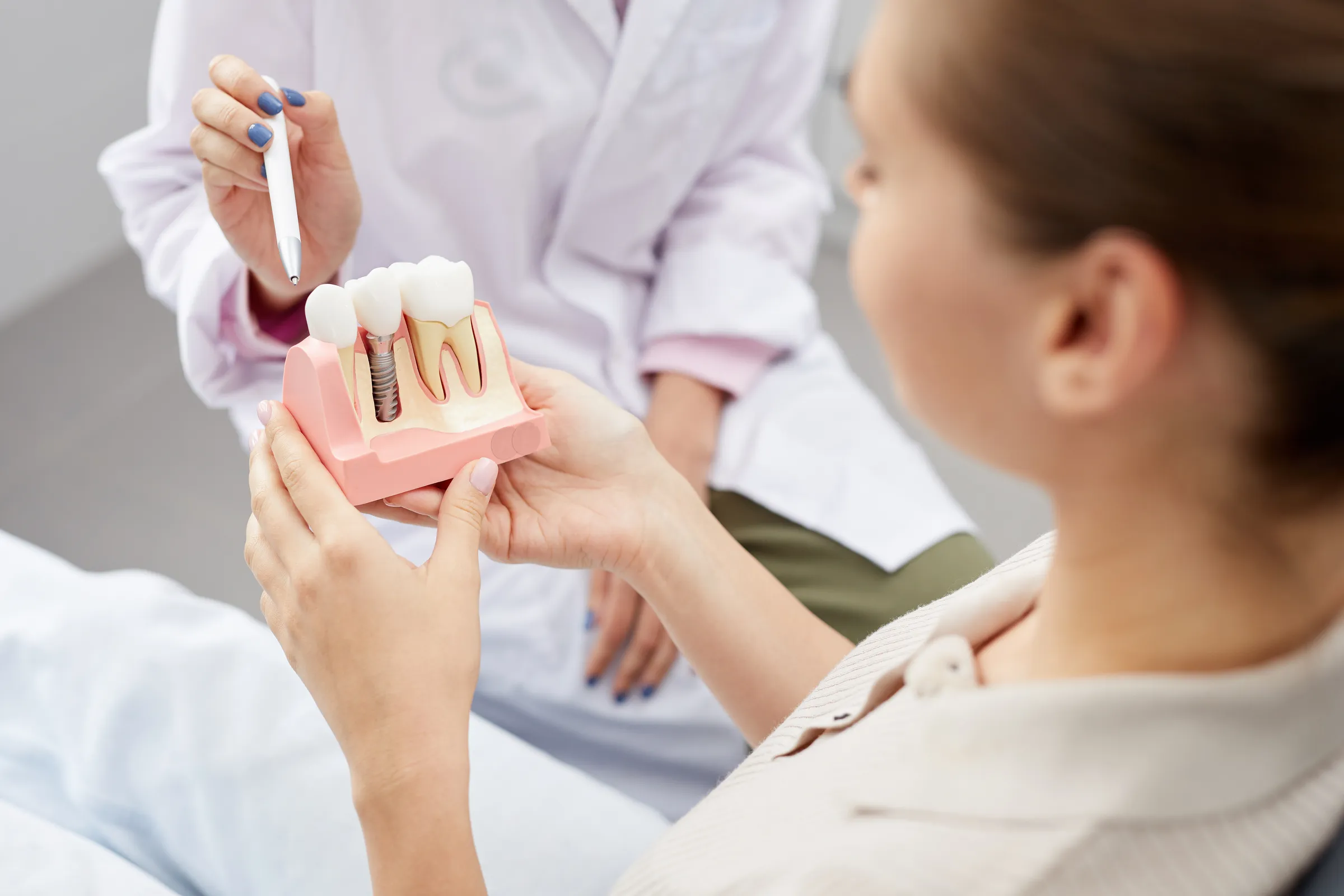 Dental Implants Los Angeles