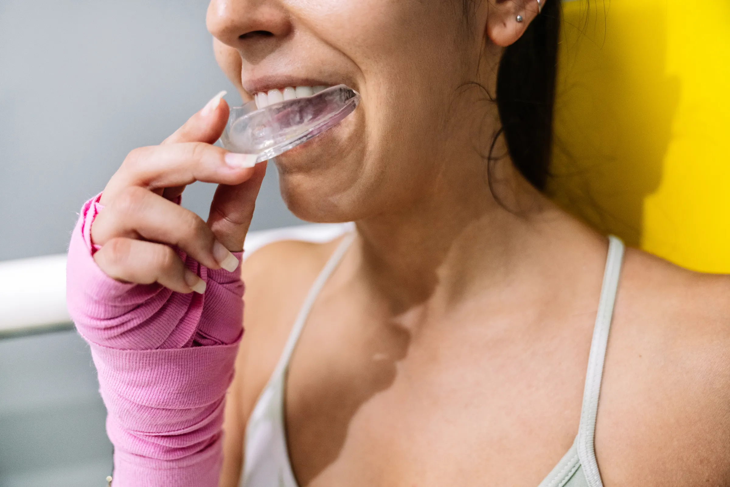 dental mouth guards los angeles ca