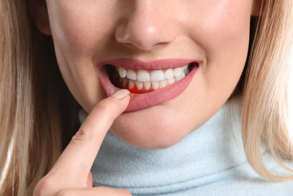 Periodontal Dentistry Los Angeles, CA