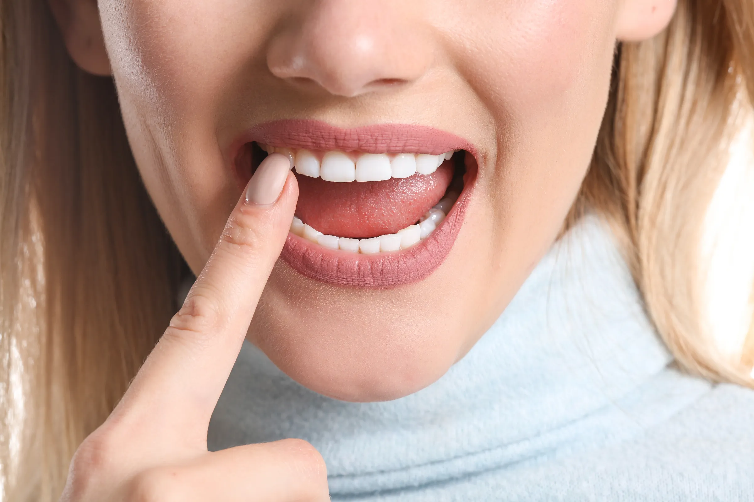 teeth whitening los angeles​