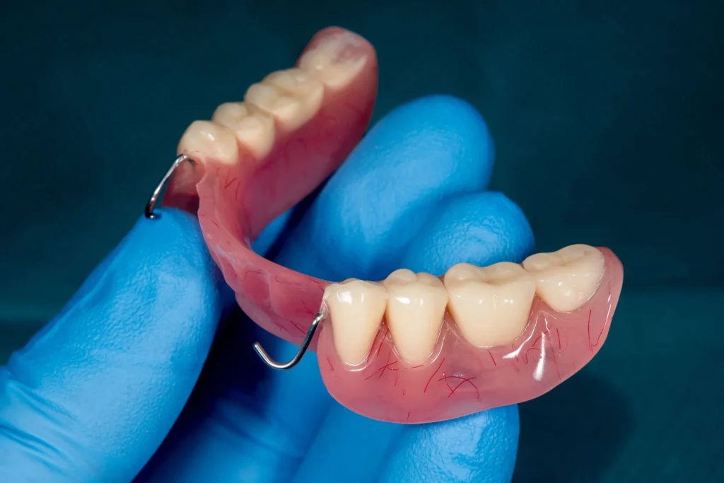 Partial dentures in Los Angeles CA designed for comfortable tooth replacement
